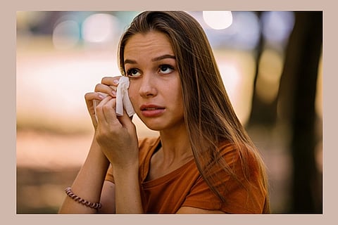 Representative image