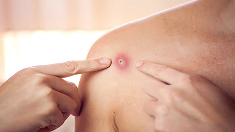 Representative Image