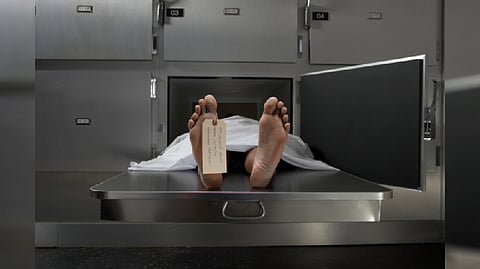 Representative image