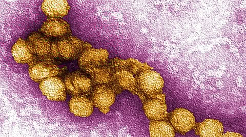 Representative image