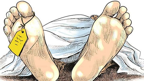 Representative Image