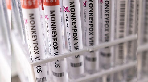 Representative image