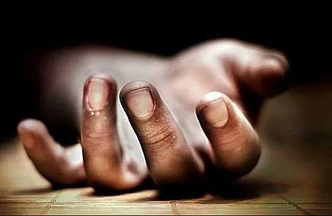 Representative image