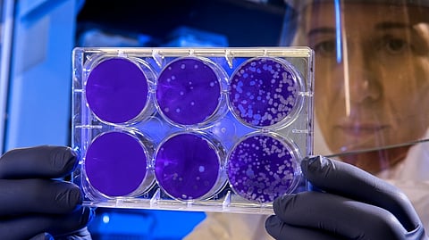 Representative image