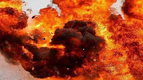 Representative image