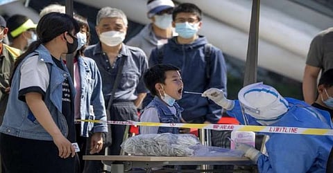 Representative image