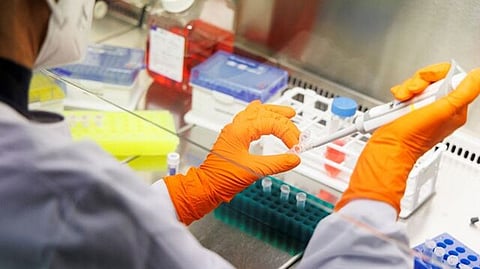 Representative image