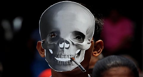 Representative Image