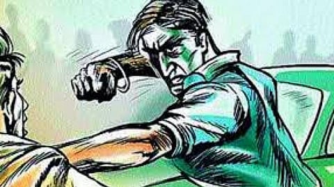 Representative Image