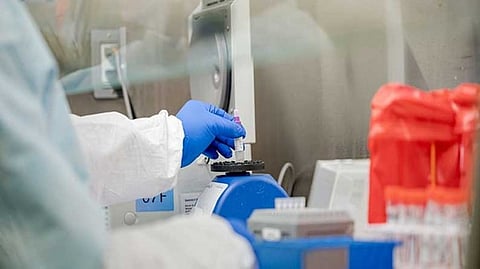 Representative image