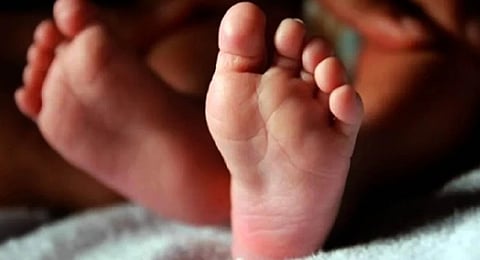 Representative Image