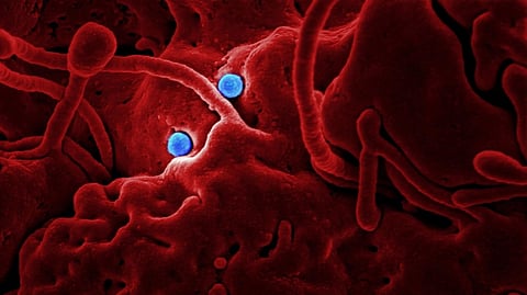 Representative image