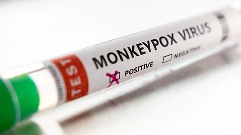 Representative image