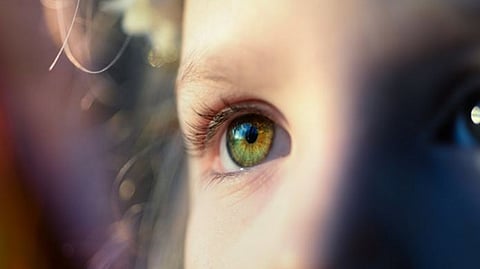 Representative image