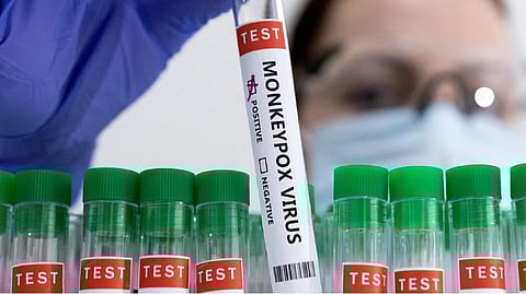 Representative image