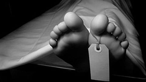 Representative image