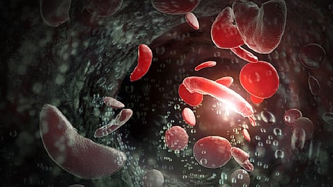 Representative image