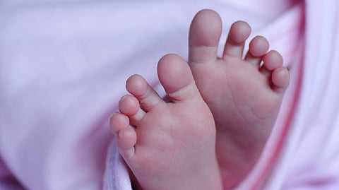 Representative image