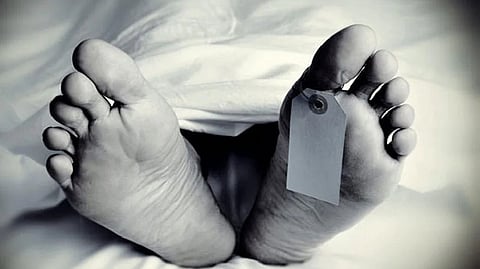 Representative image