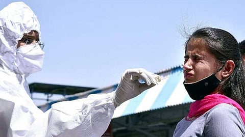 Representative image