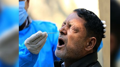 Representative image