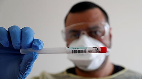 Representative image