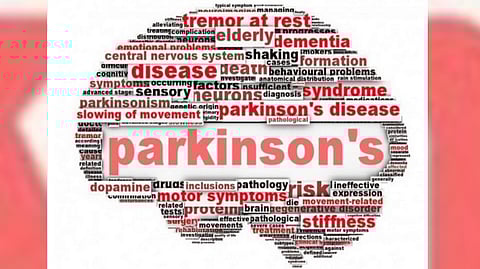 Representative image