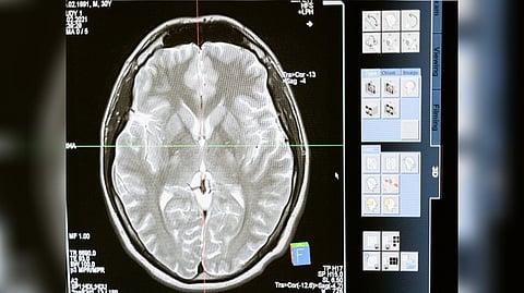 Representative image