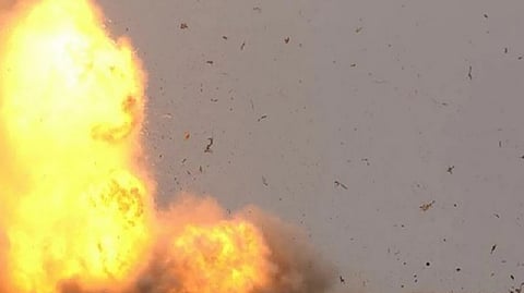 Representative image