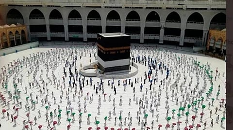 Representative image