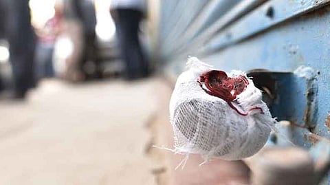 Representative Image