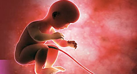 Representative Image