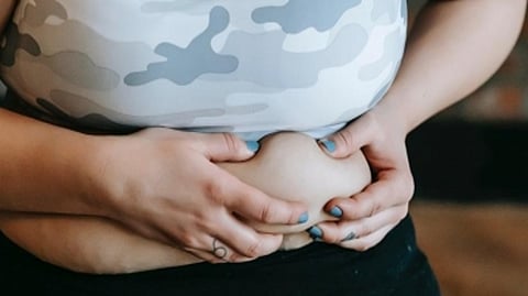 Representative image