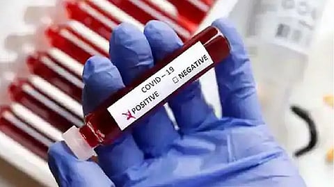 Representative image