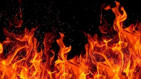 Representative Image