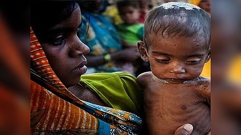 Representative image