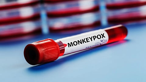 Representative image