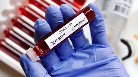 Representative image