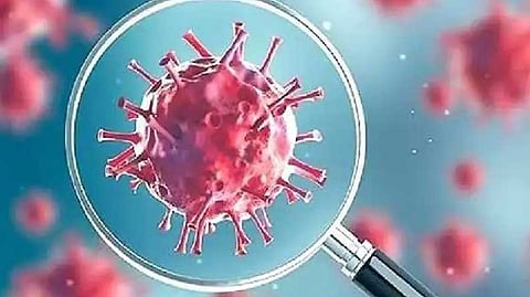 Representative image