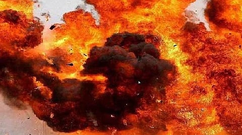 Representative image