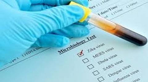 Representative image