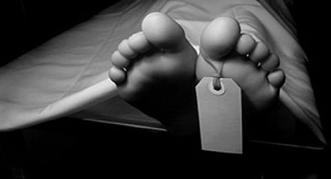 Representative Image