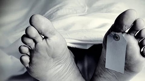 Representative image