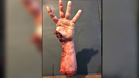 Representative image