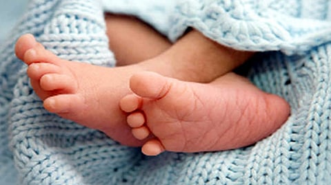 Representative Image