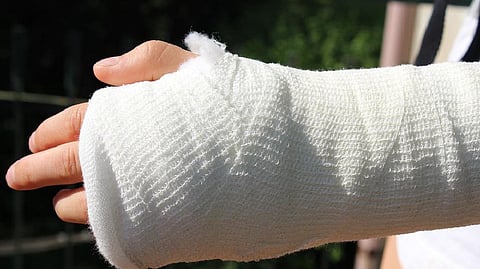 Representative image