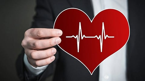 Representative image