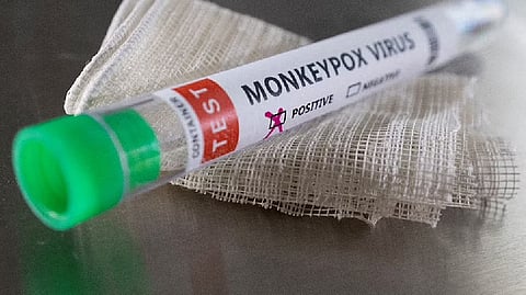 Representative Image