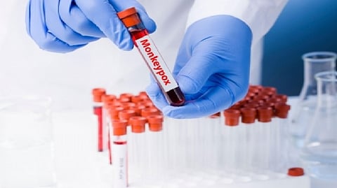 Monkeypox vaccination centre opens in Paris