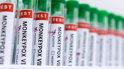 Representative Image